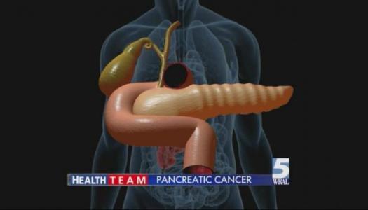 pancreaticcancer.jpg